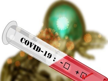 Zakon o začasnih ukrepih za omilitev in odpravo posledic COVID-19 (ZZUOOP)